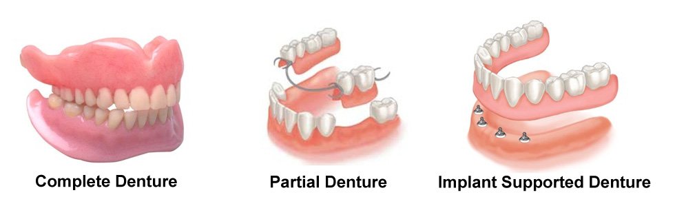 Dentures