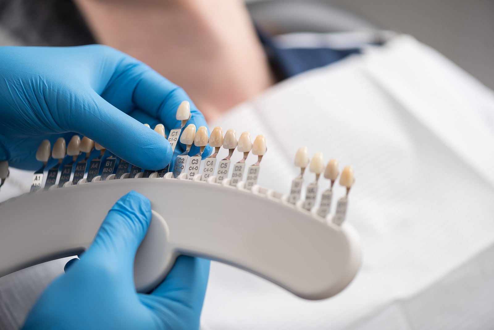 Dental Crowns in Costa Rica