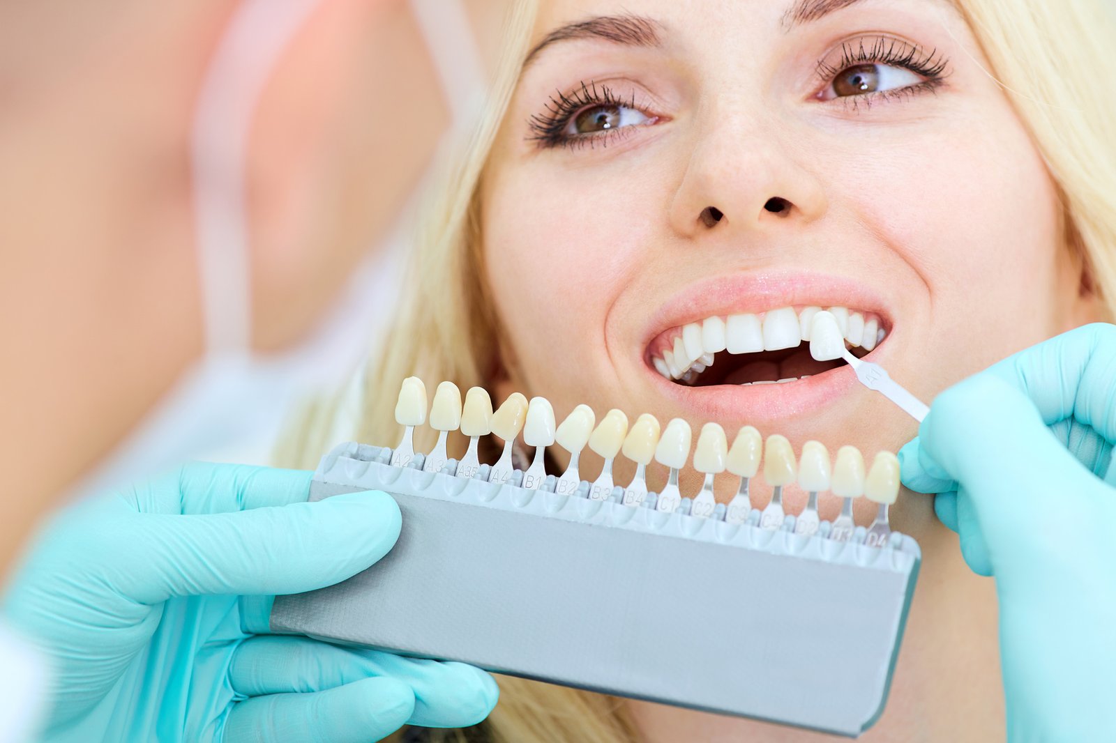 A Complete Guide to Dental Implants in Costa Rica