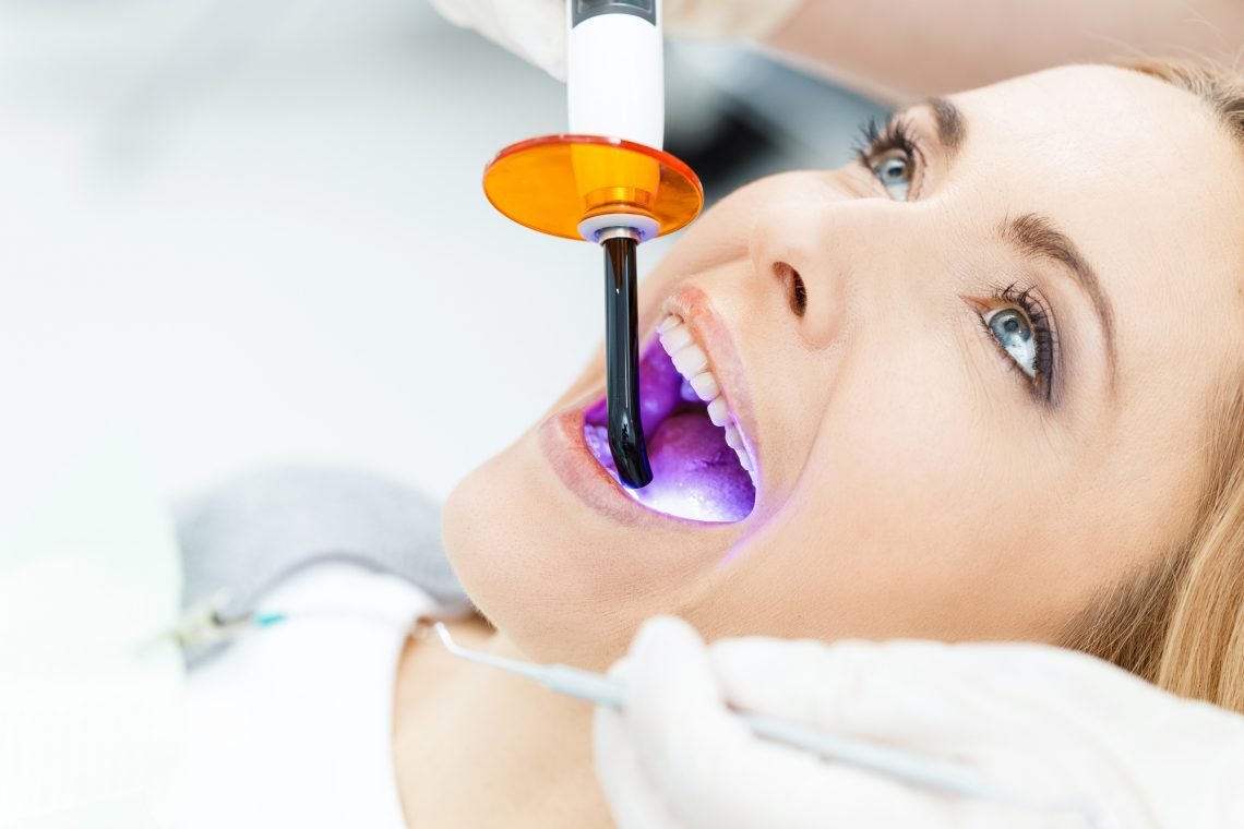 teeth whitened professionally