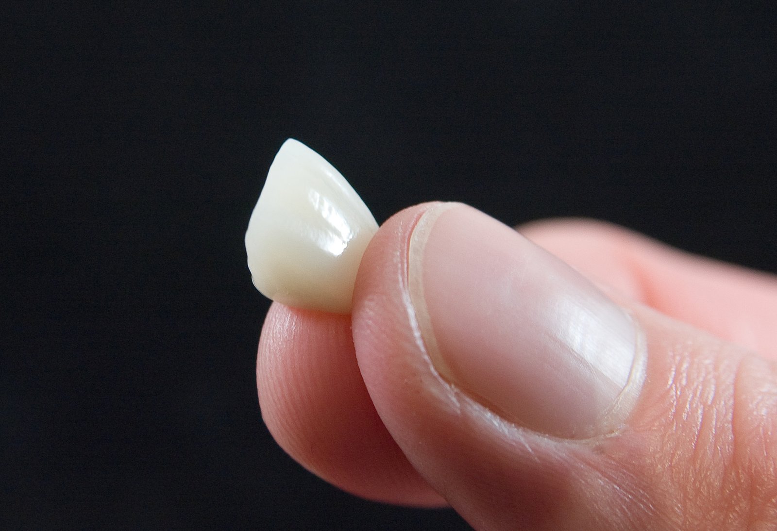 Costa Rica dental crowns