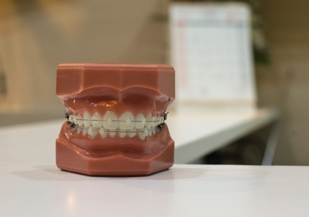What Are Dental Inlays And Onlays The Only Guide You Will Need